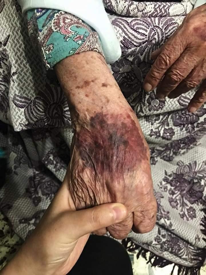 الاعتداء على ام جبر 2.jpg