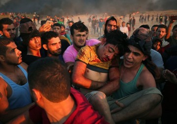 7 شهداء ومئات الاصابات في جمعة "انتفاضة القدس"