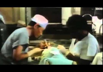 روسي يخضع لعملية زراعة رأس في جسم شخص متوفى