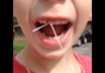 شاهد: أب يخلع ضرس ابنه باستخدام.. السيارة!