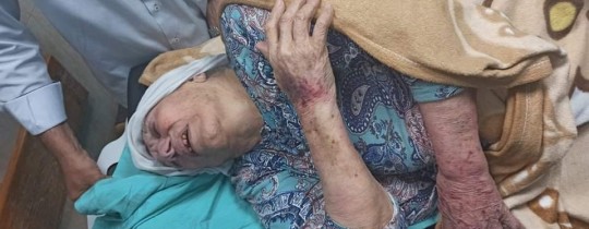 صورة لأم جبر وشاح أثناء نقلها للمستشفى