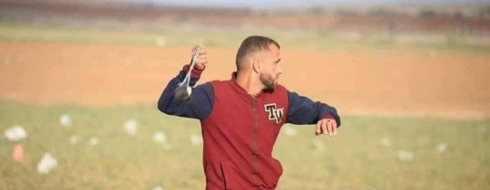 الراس: حرق الجرحى بدمائهم وحاجاتهم الإنسانيّة جريمة لا يُسكت عنها