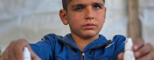 الطفل عبد الرحمن الشرافي يواجه خطر فقدان بصره بشكل كامل..