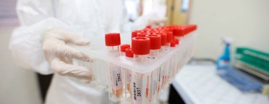 فحوصات كورونا