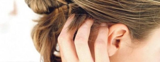 قشرة الرأس خلال فصل الشتاء تحدث نتيجةً لعدّة عوامل تتسبب بجفاف فروة الرأس