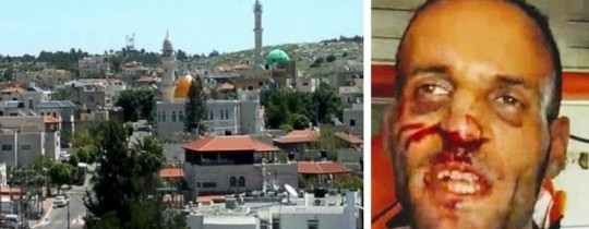 شرطة الاحتلال تعتدي على فلسطيني في الأراضي المحتلة 1948