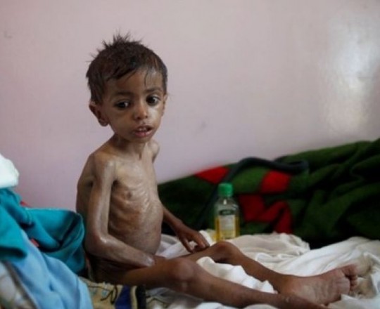 هيومن رايتس: ادعاءات السعودية بتخفيف الحصار عن اليمن غير صحيحة