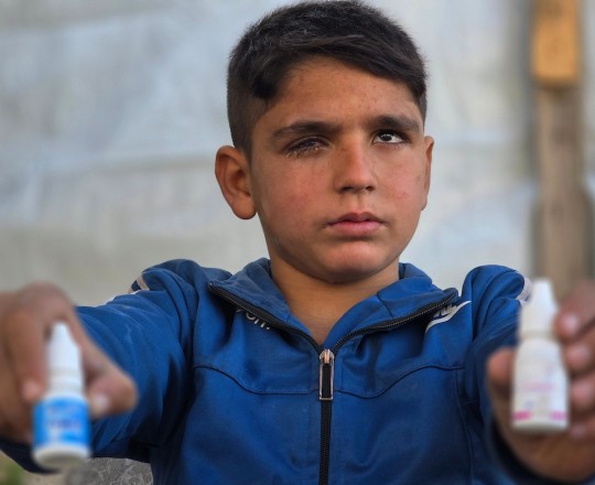 الطفل عبد الرحمن الشرافي يواجه خطر فقدان بصره بشكل كامل..