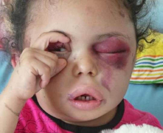 بثينة الريمي 