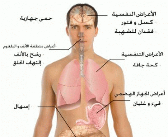 انفلونزا الخنازير