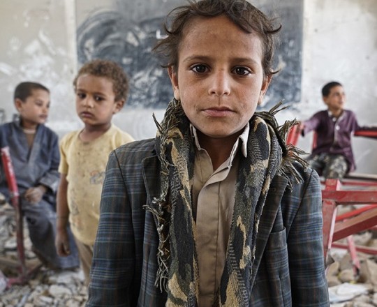 أطفال اليمن